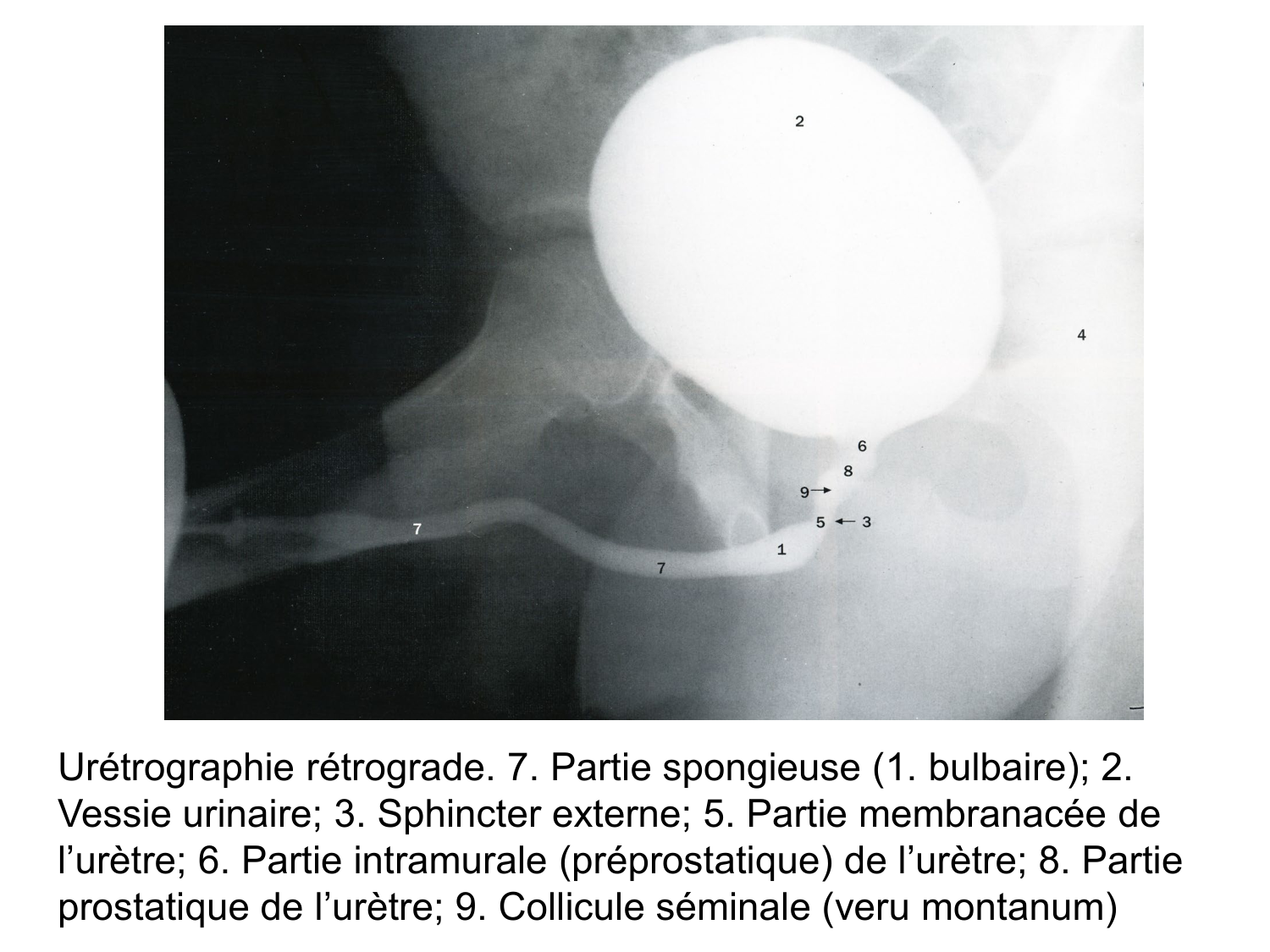 Rein, voies urinaires et retropéritoine page 83