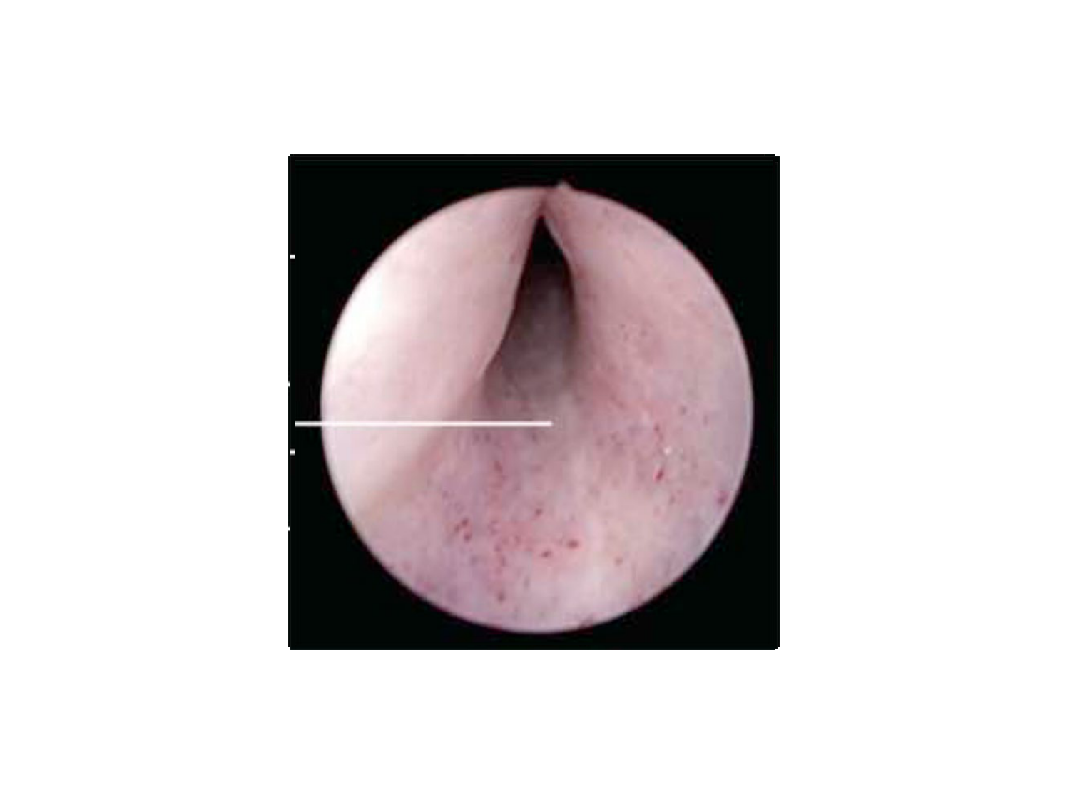 Rein, voies urinaires et retropéritoine page 84