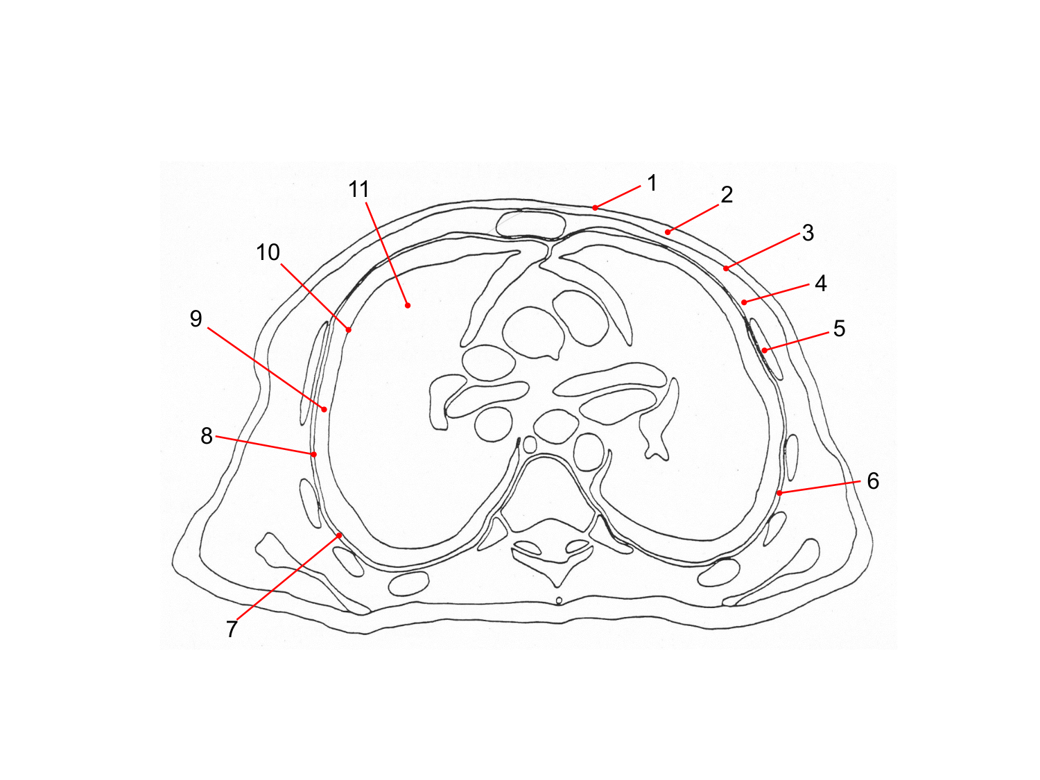 Splanchnologie generale; Pelvis-Perinée système reproducteur (homme et femme)1 page 17