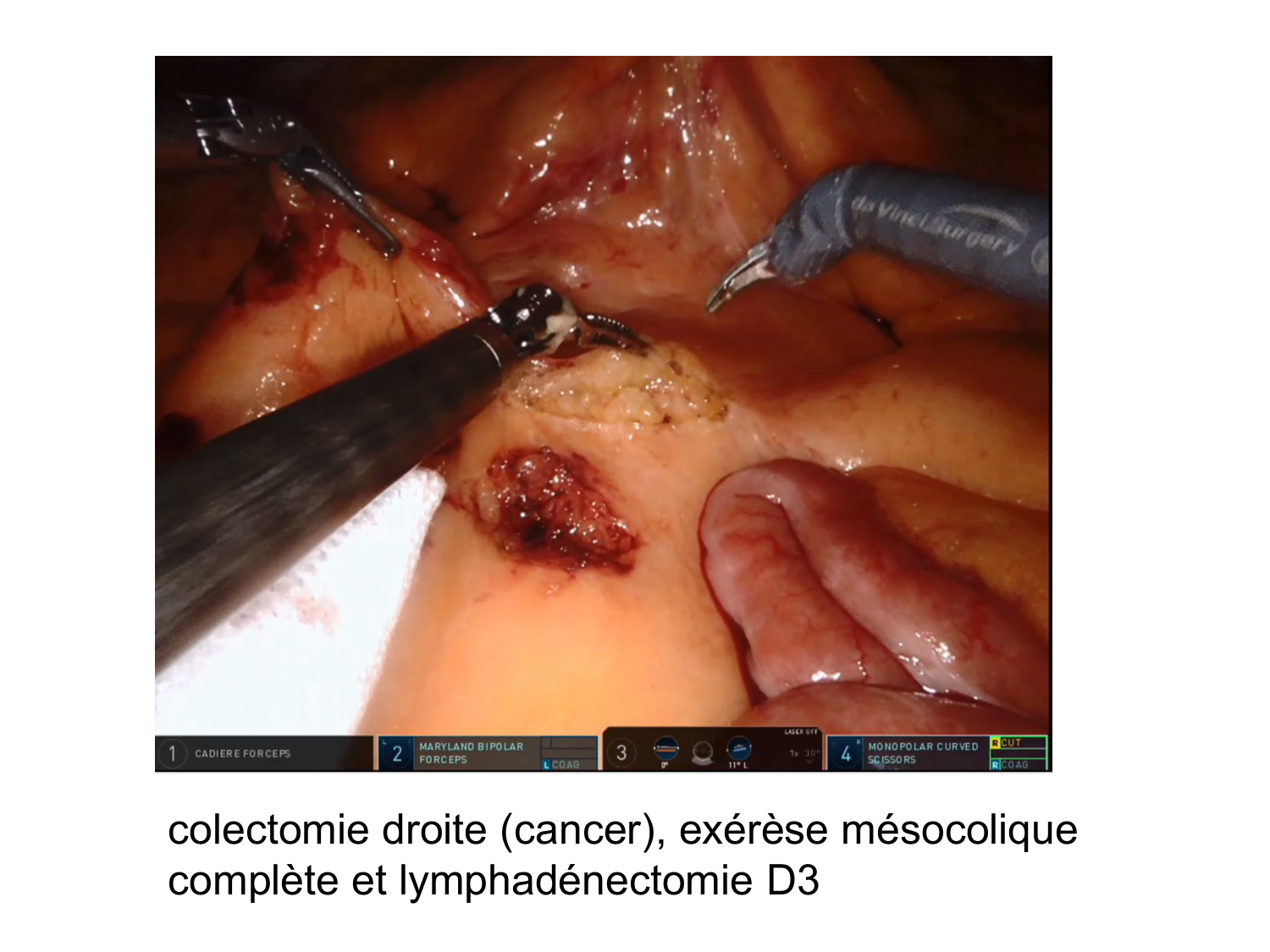 Splanchnologie generale; Pelvis-Perinée système reproducteur (homme et femme)1 page 32