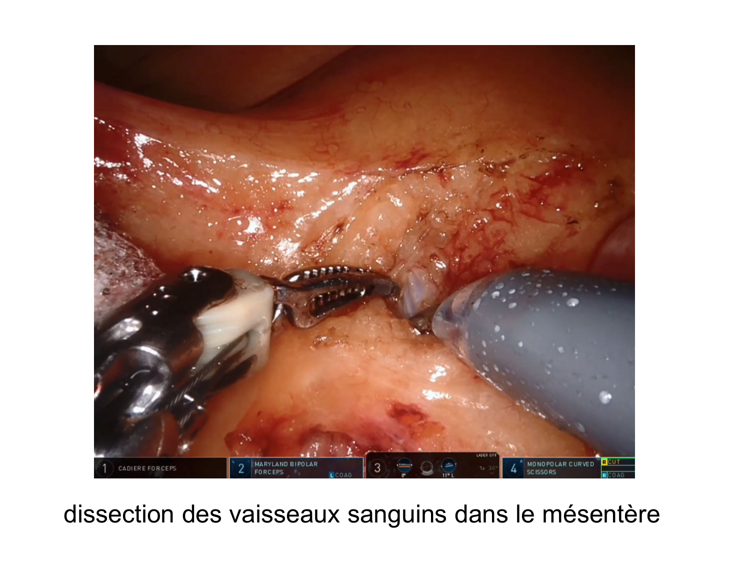 Splanchnologie generale; Pelvis-Perinée système reproducteur (homme et femme)1 page 33
