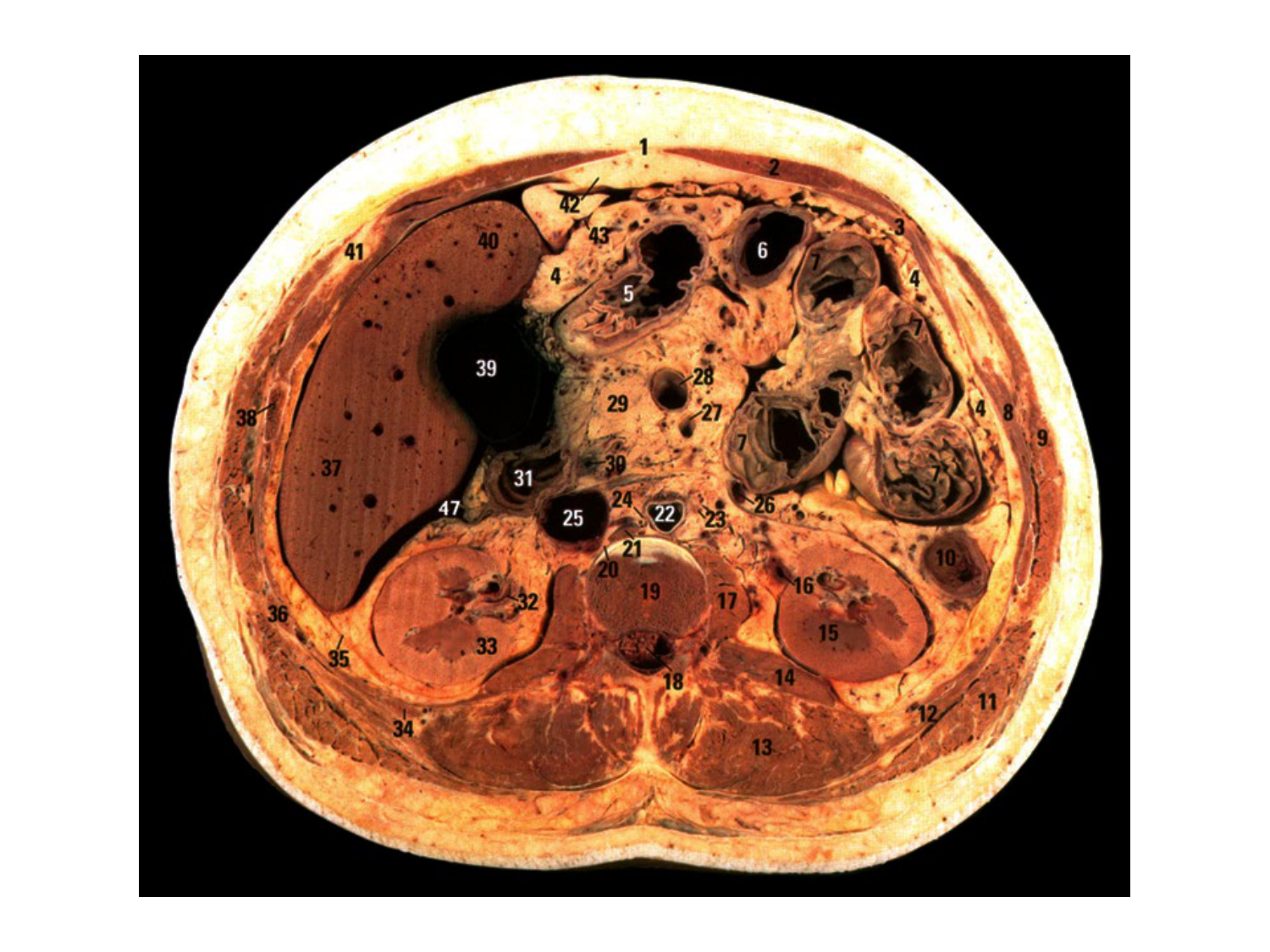 Splanchnologie generale; Pelvis-Perinée système reproducteur (homme et femme)1 page 44