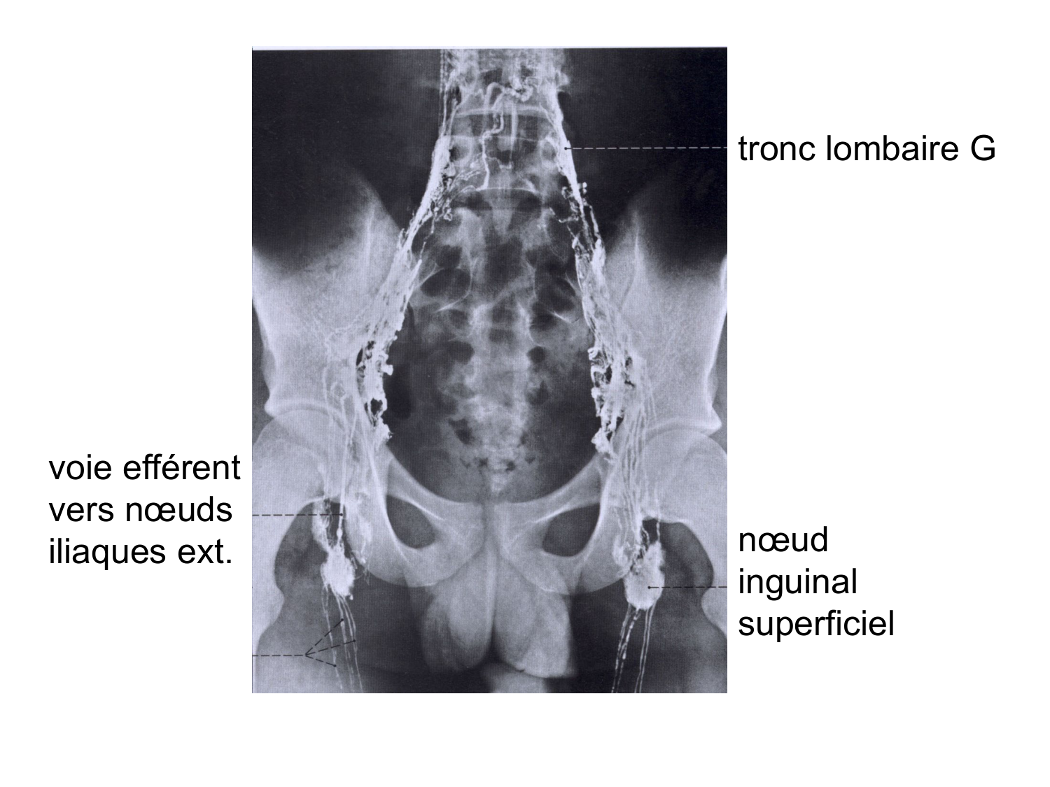Splanchnologie generale; Pelvis-Perinée système reproducteur (homme et femme)1 page 88