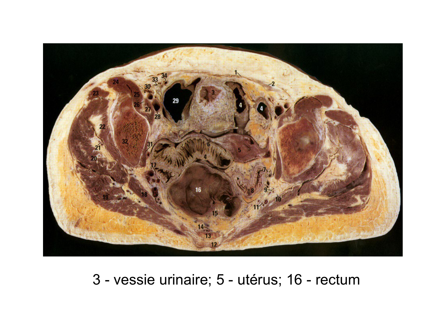 Splanchnologie generale; Pelvis-Perinée système reproducteur (homme et femme)1 page 92