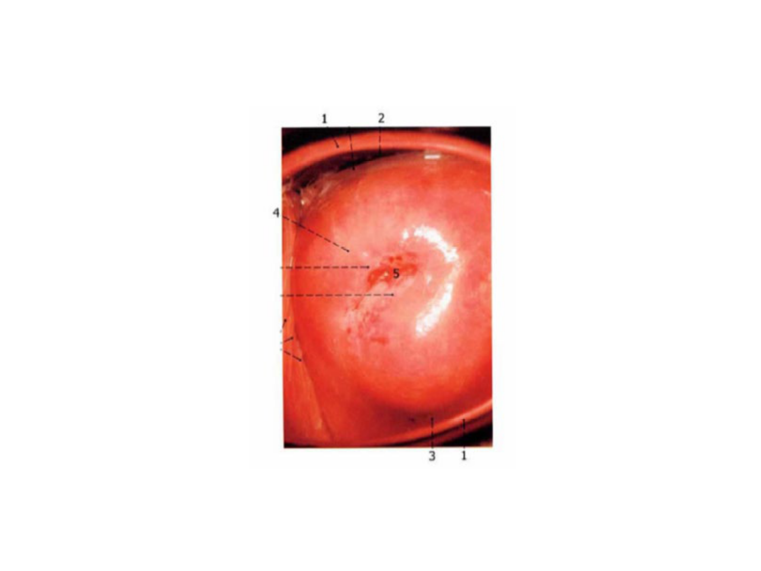 Splanchnologie generale; Pelvis-Perinée système reproducteur (homme et femme)1 page 102