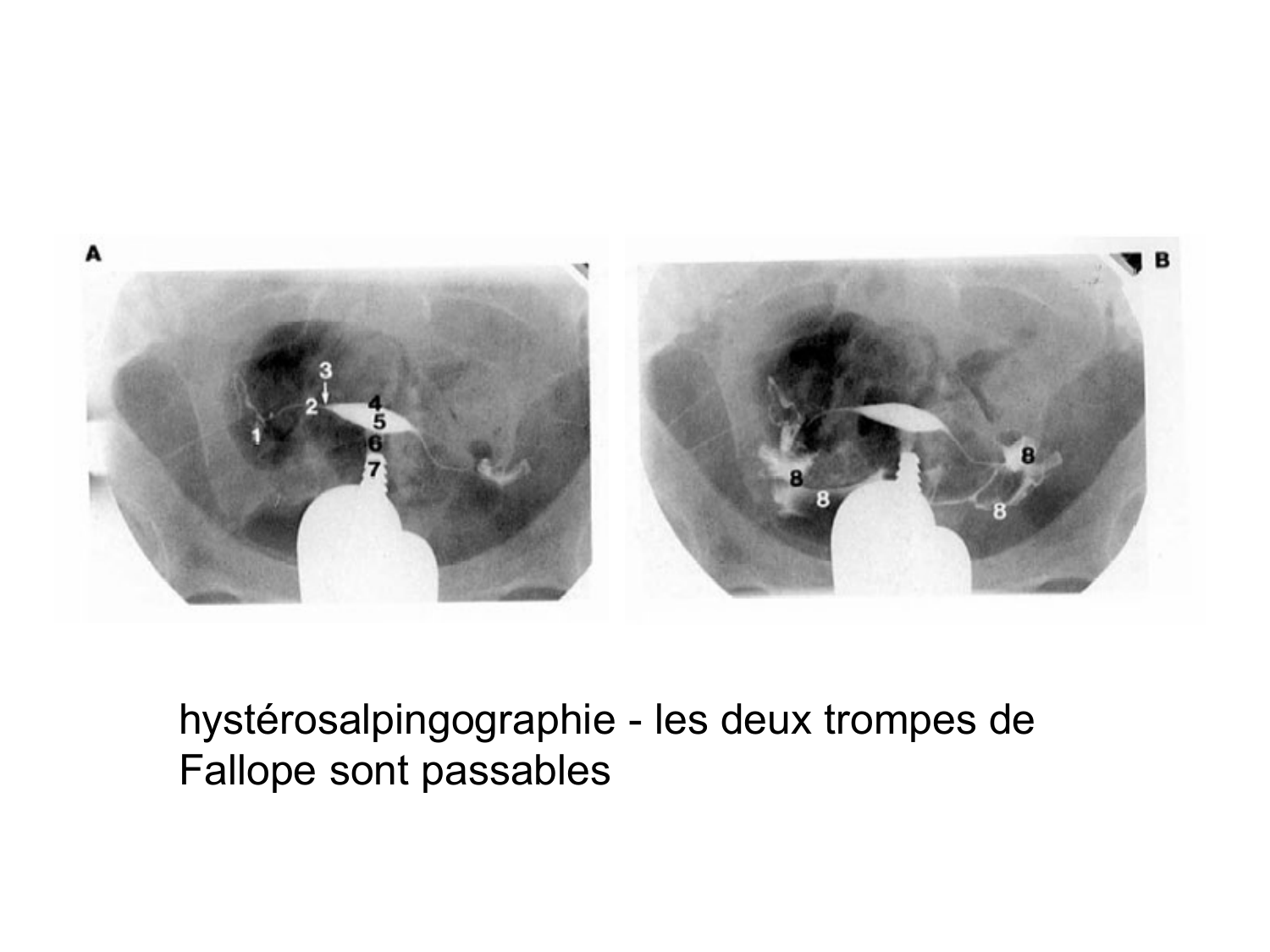 Splanchnologie generale; Pelvis-Perinée système reproducteur (homme et femme)1 page 111
