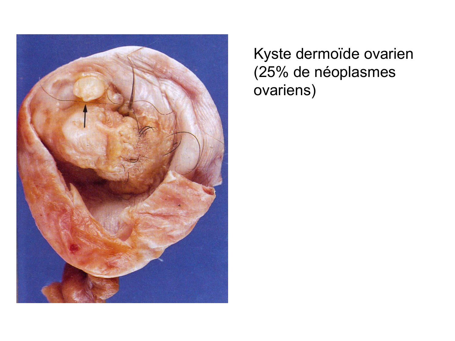 Splanchnologie generale; Pelvis-Perinée système reproducteur (homme et femme)1 page 122