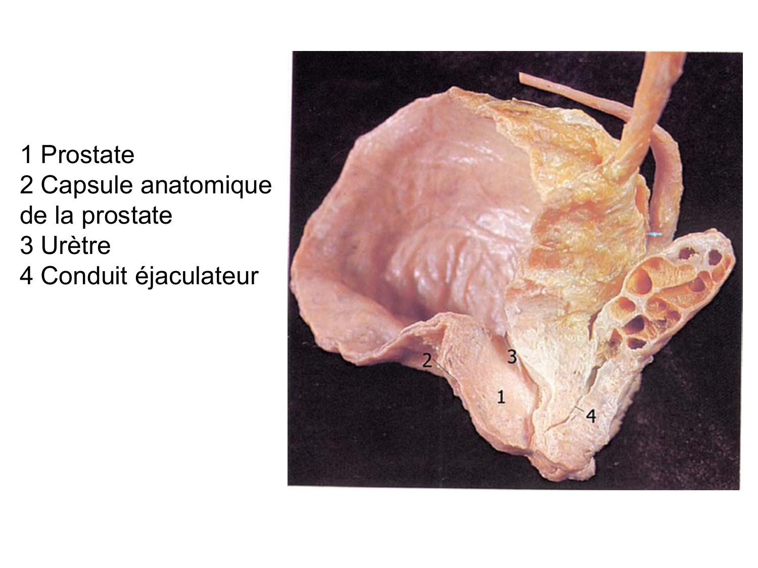 Splanchnologie generale; Pelvis-Perinée système reproducteur (homme et femme)1 page 159