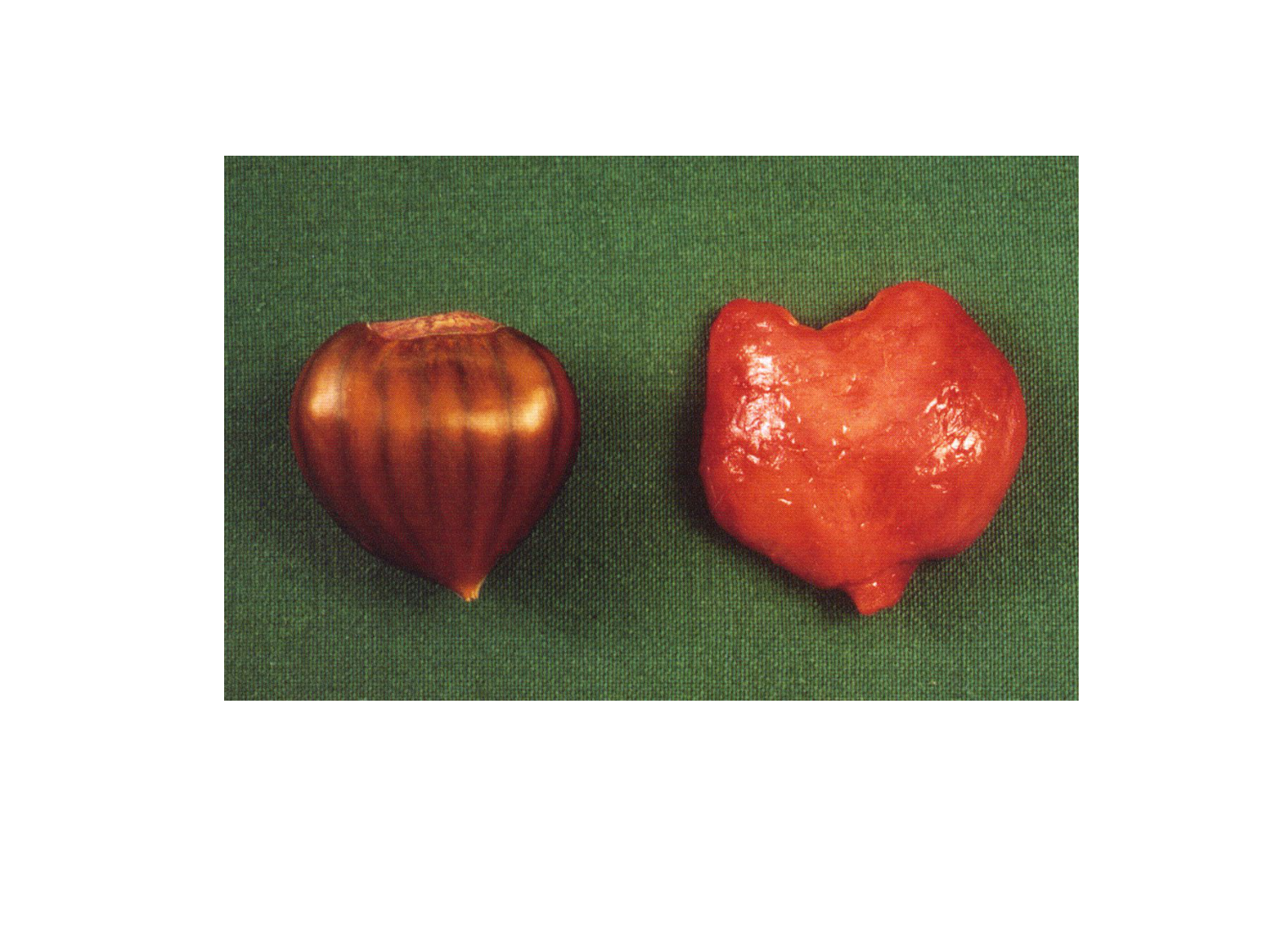 Splanchnologie generale; Pelvis-Perinée système reproducteur (homme et femme)1 page 161