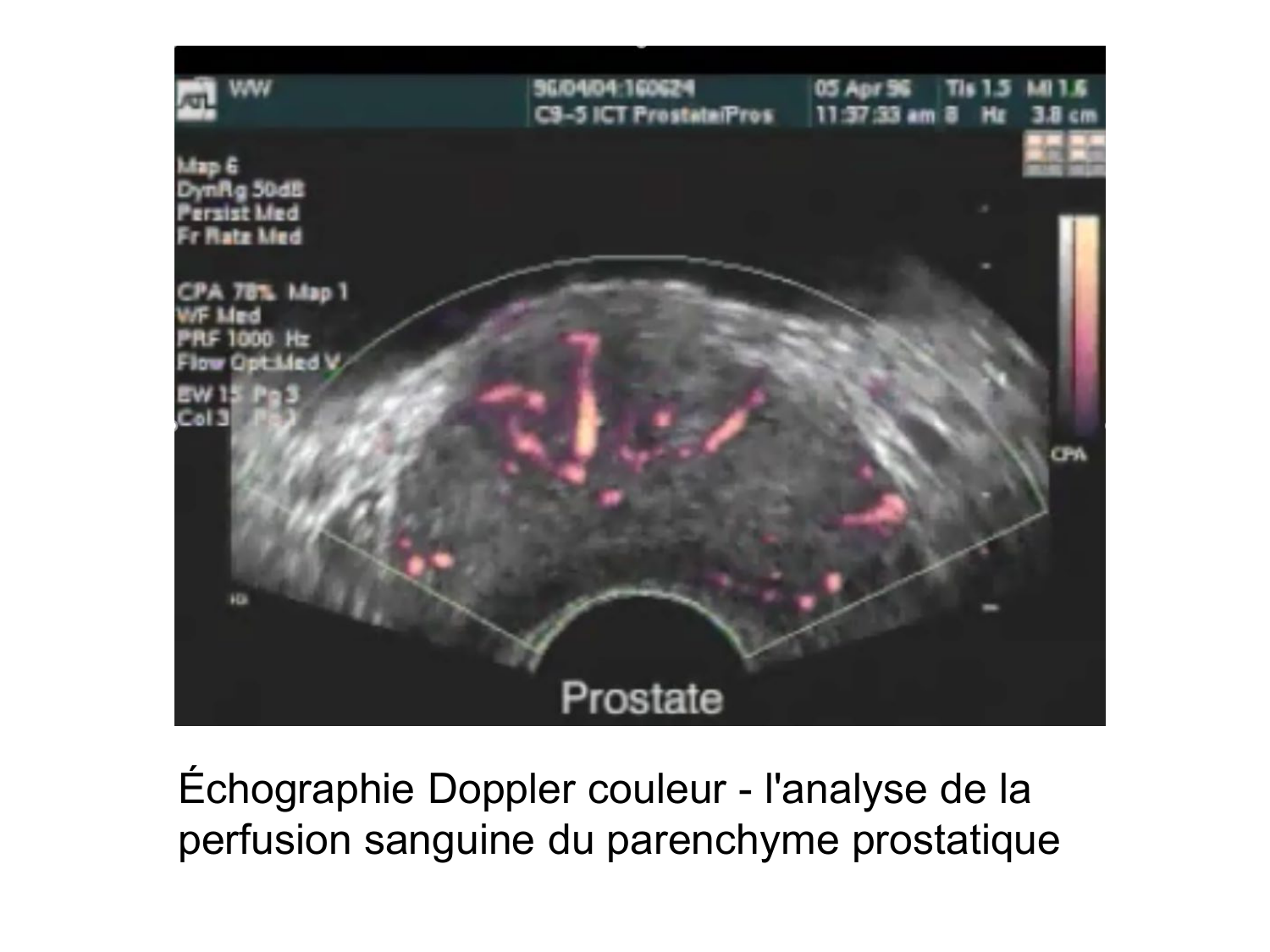 Splanchnologie generale; Pelvis-Perinée système reproducteur (homme et femme)1 page 168