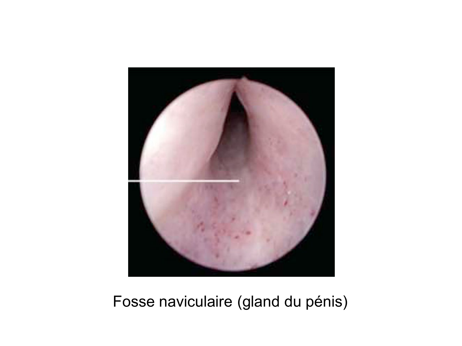 Splanchnologie generale; Pelvis-Perinée système reproducteur (homme et femme)1 page 172