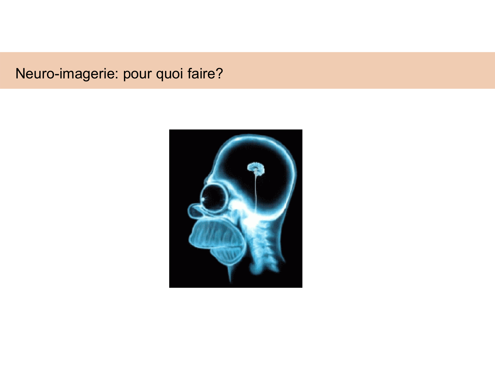 BA1 Techniques de Neuroimagerie page 11