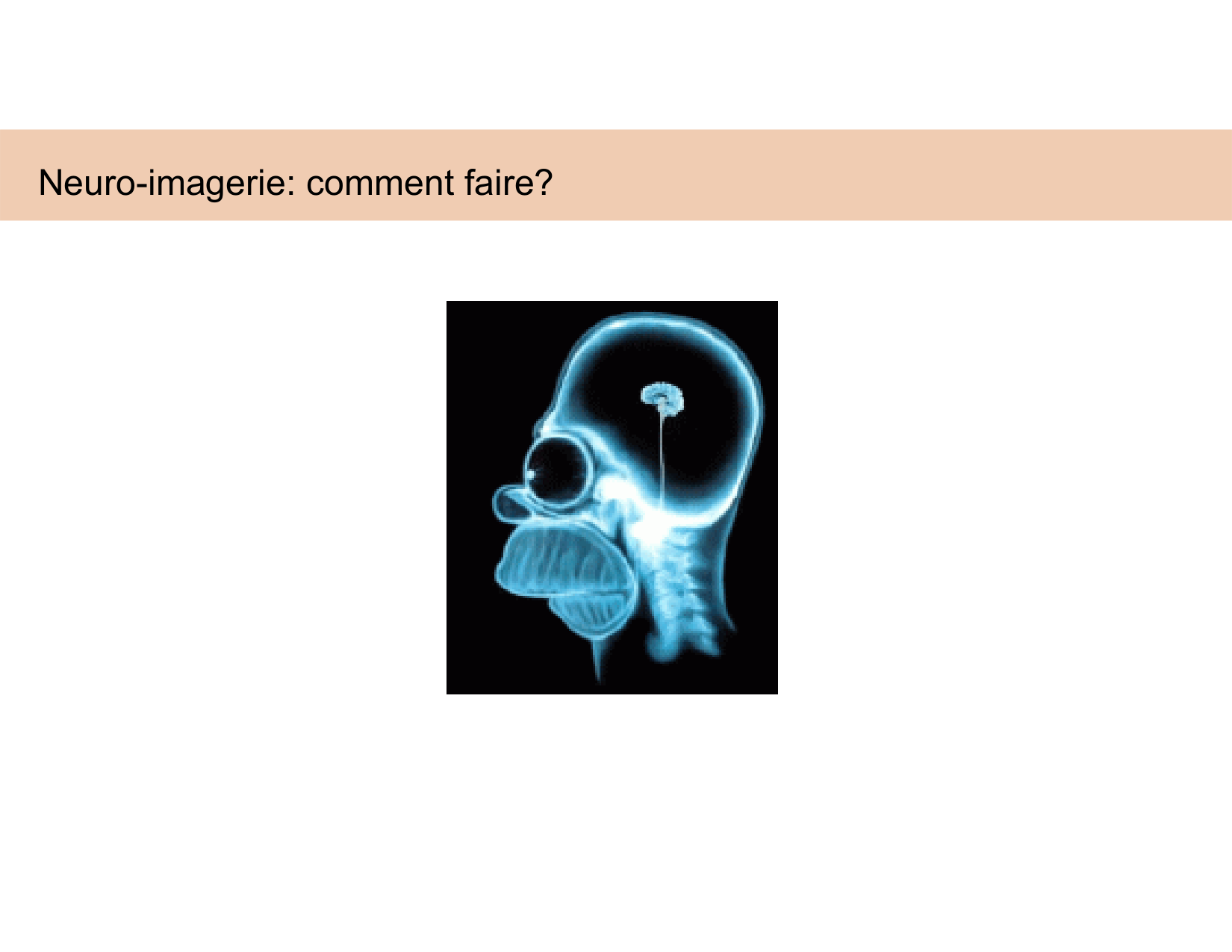 BA1 Techniques de Neuroimagerie page 14