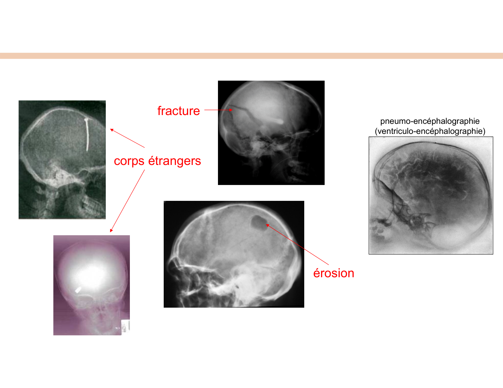 BA1 Techniques de Neuroimagerie page 18