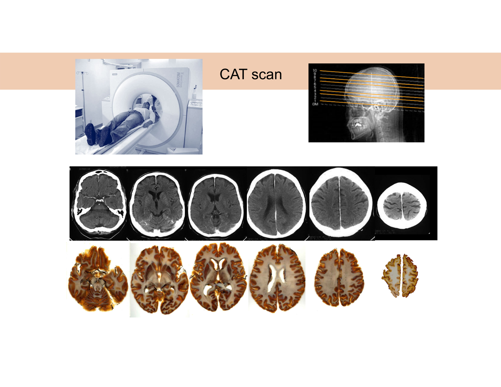 BA1 Techniques de Neuroimagerie page 20