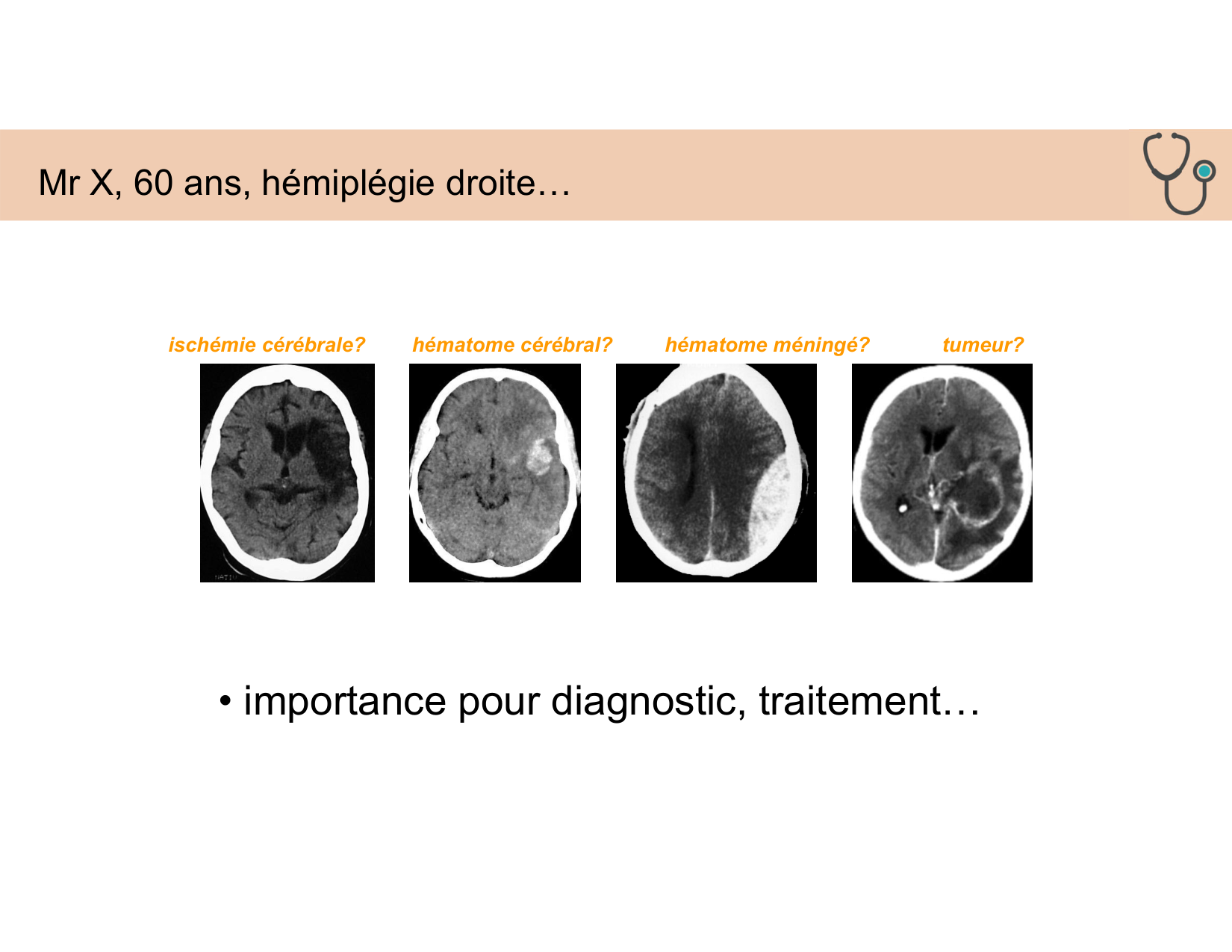 BA1 Techniques de Neuroimagerie page 21
