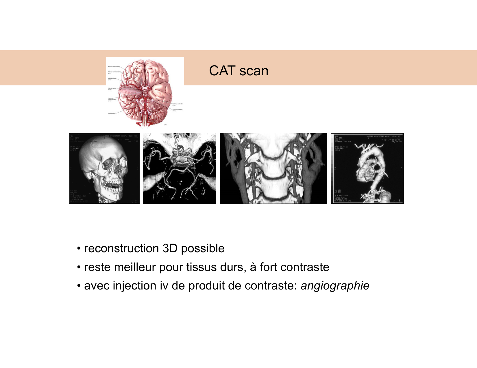 BA1 Techniques de Neuroimagerie page 22