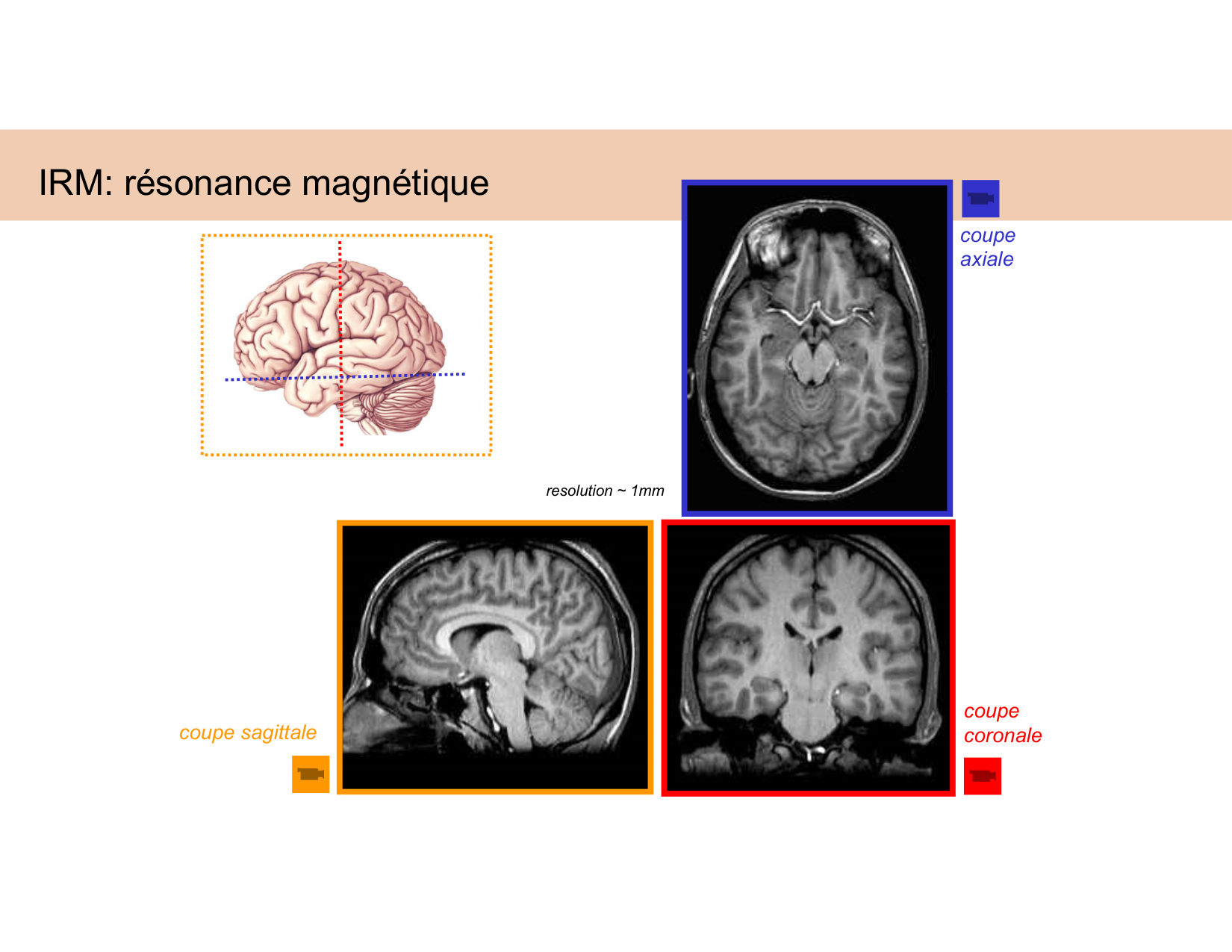 BA1 Techniques de Neuroimagerie page 25