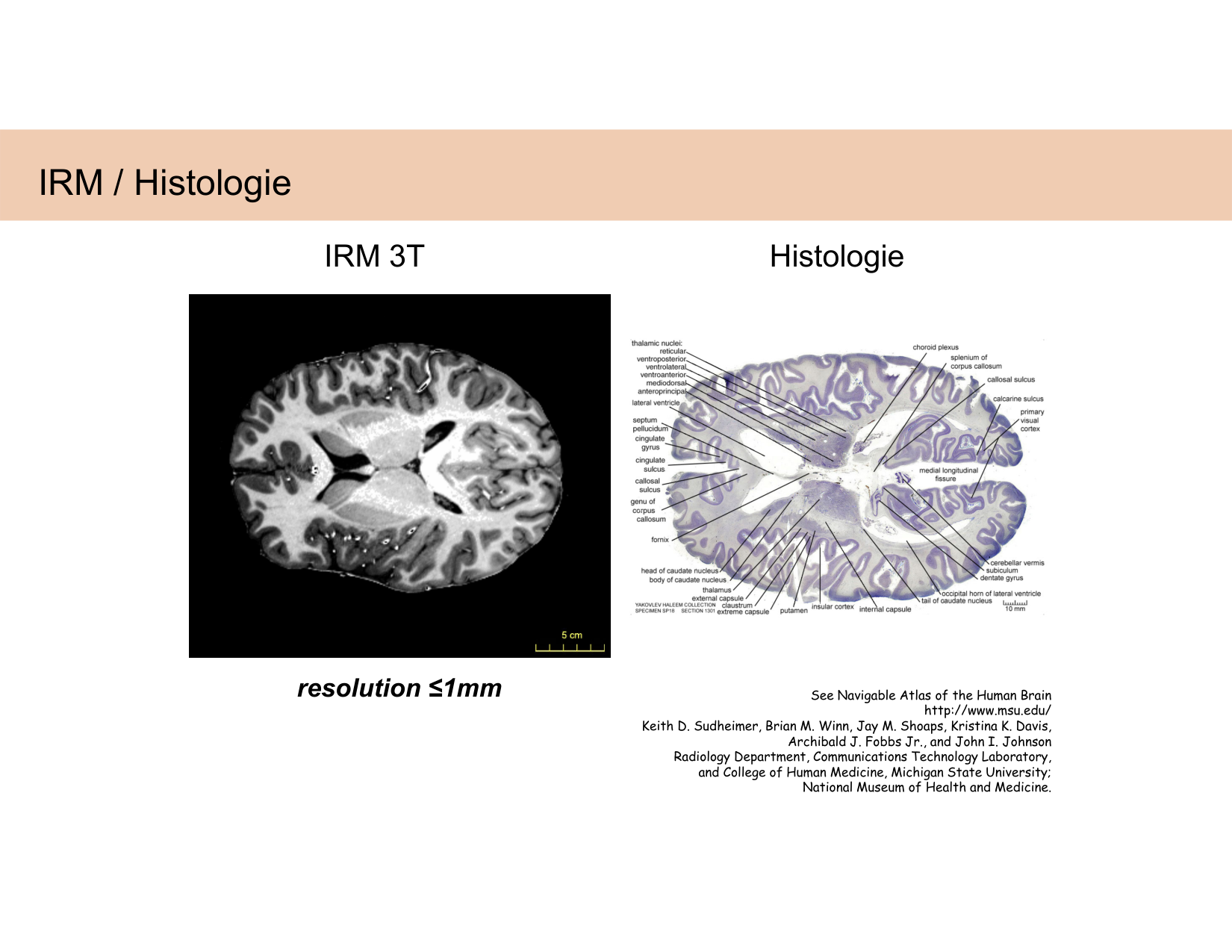 BA1 Techniques de Neuroimagerie page 26