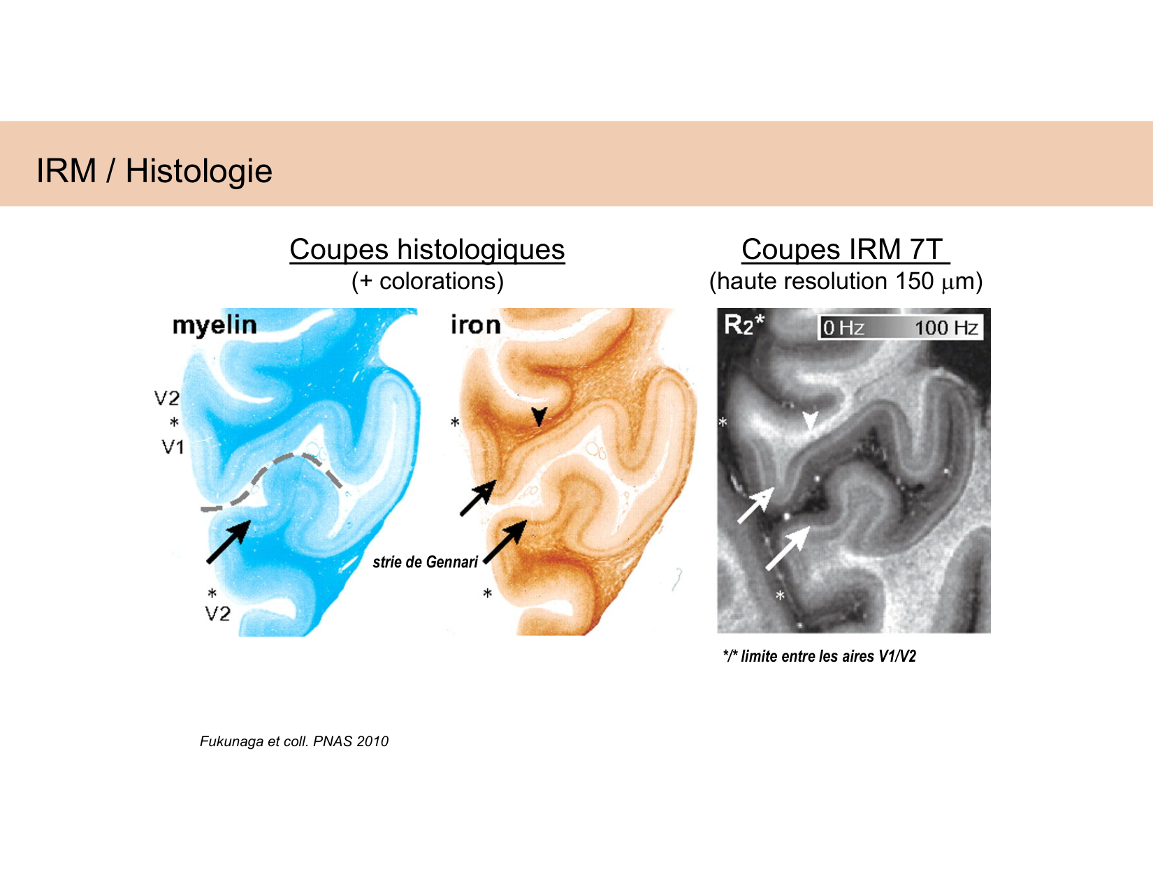 BA1 Techniques de Neuroimagerie page 27