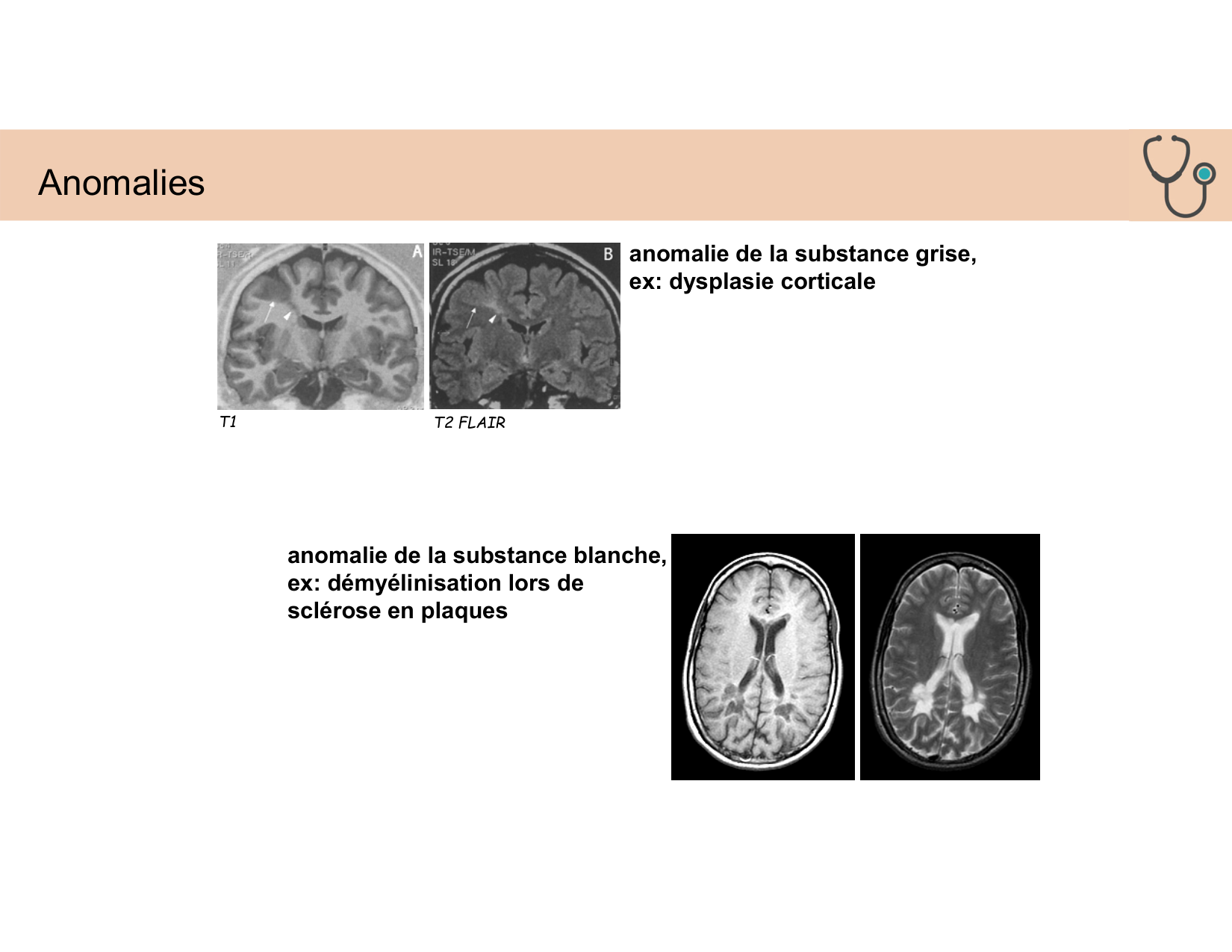 BA1 Techniques de Neuroimagerie page 28