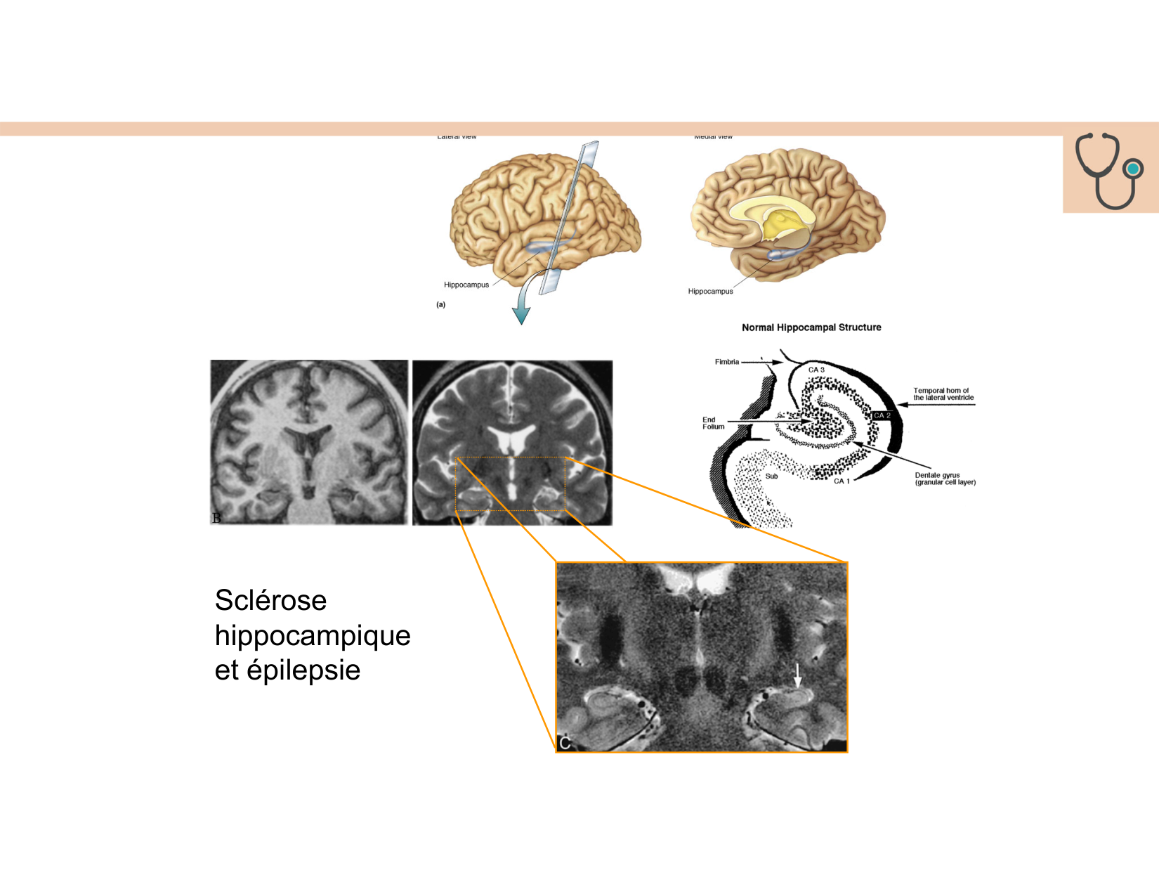 BA1 Techniques de Neuroimagerie page 29
