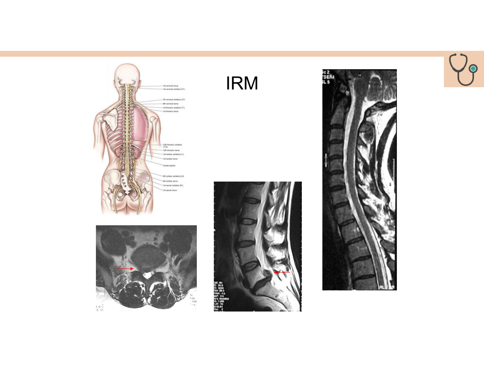 BA1 Techniques de Neuroimagerie page 30
