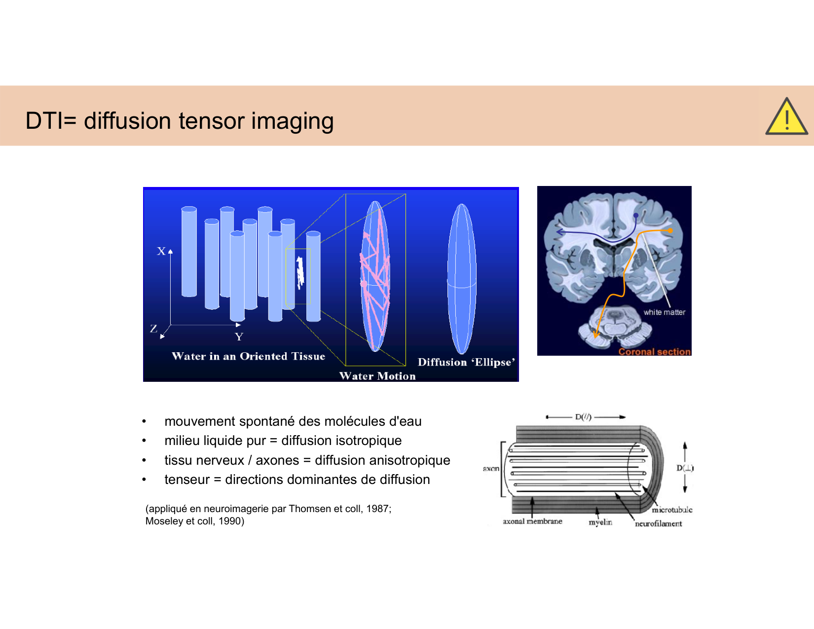 BA1 Techniques de Neuroimagerie page 34