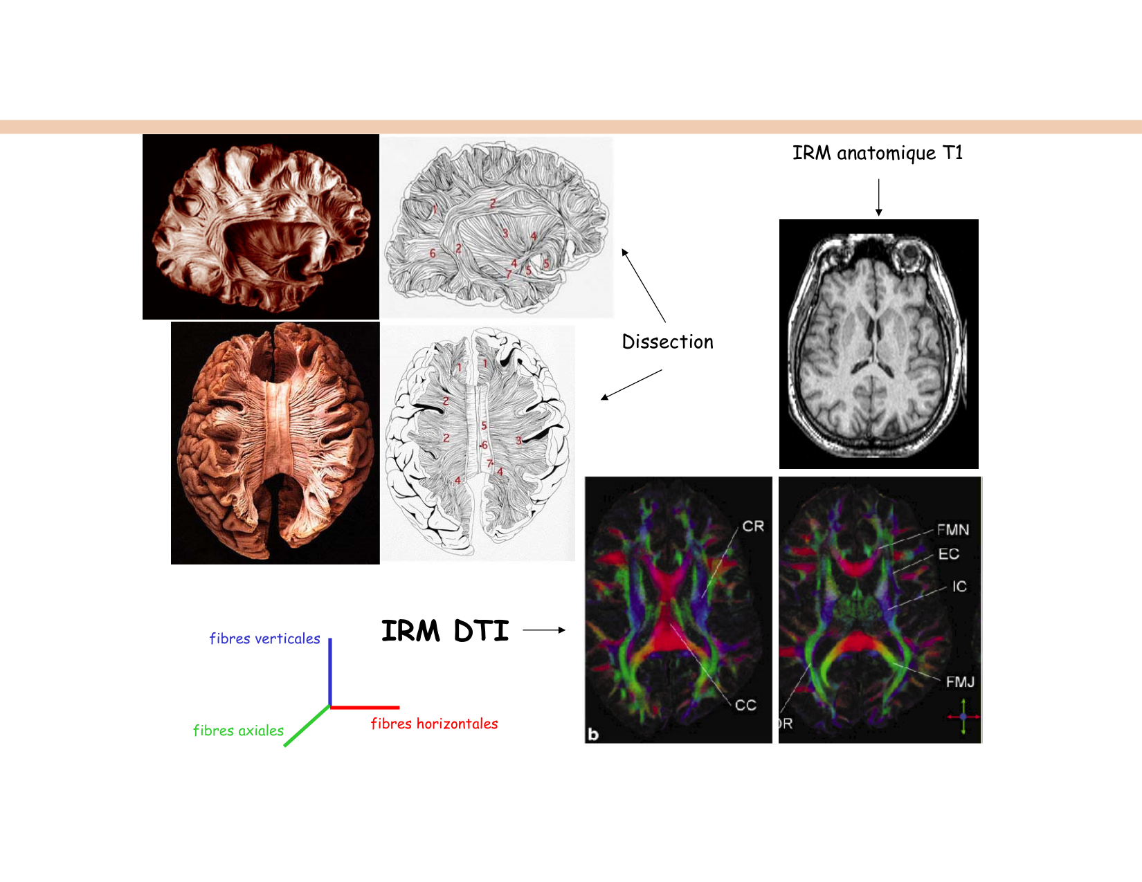 BA1 Techniques de Neuroimagerie page 35