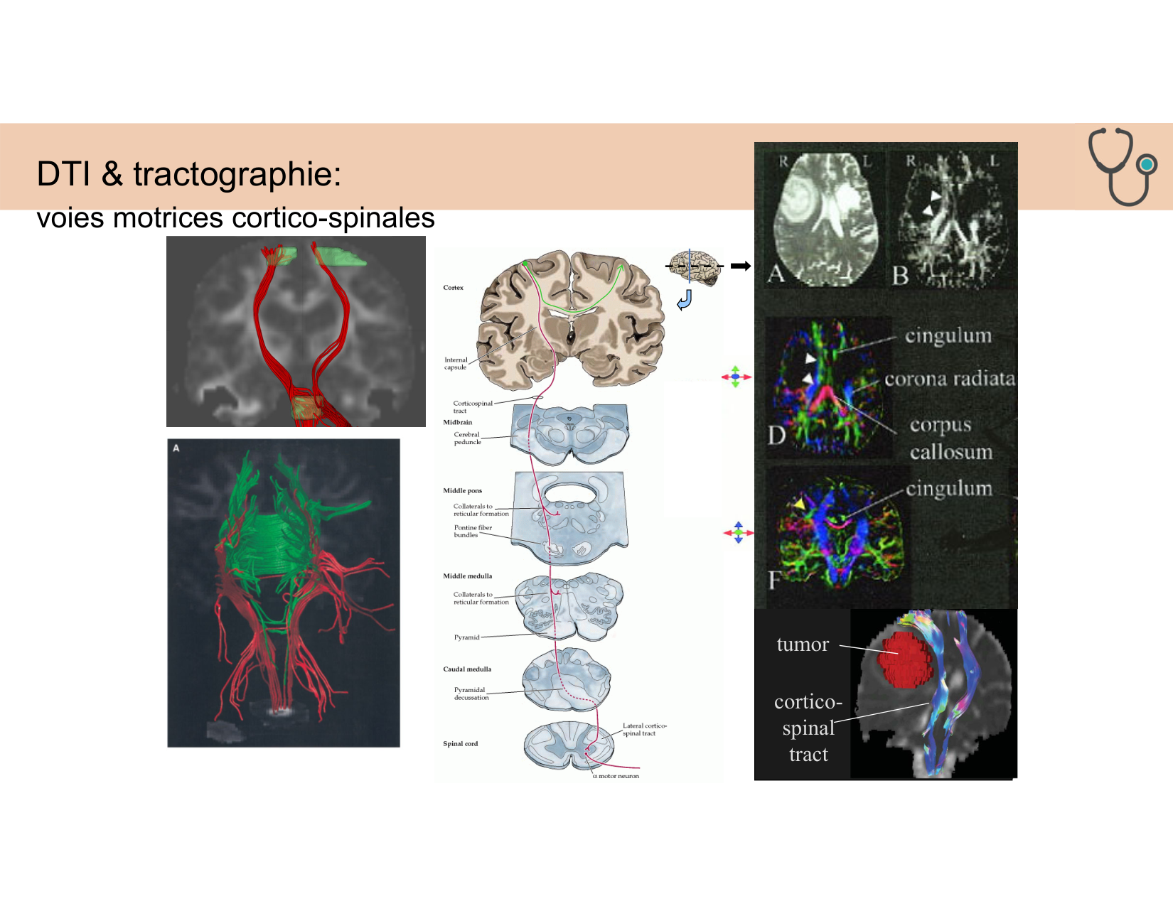 BA1 Techniques de Neuroimagerie page 36