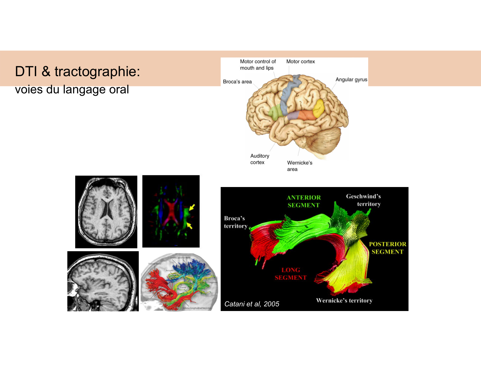 BA1 Techniques de Neuroimagerie page 37