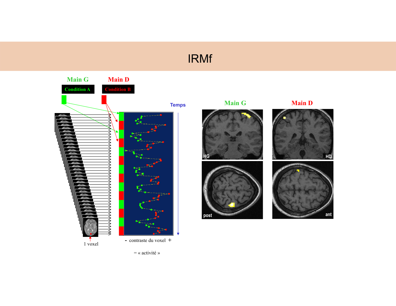 BA1 Techniques de Neuroimagerie page 41