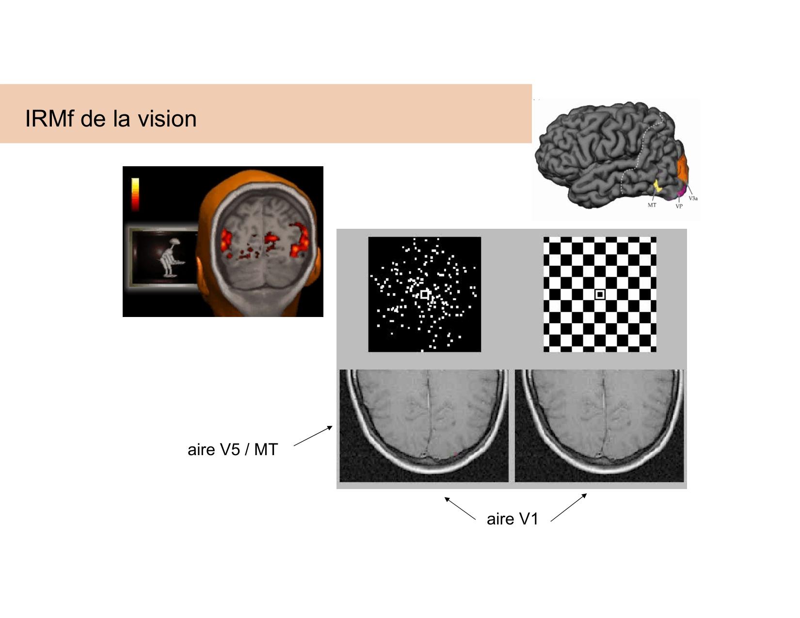 BA1 Techniques de Neuroimagerie page 42