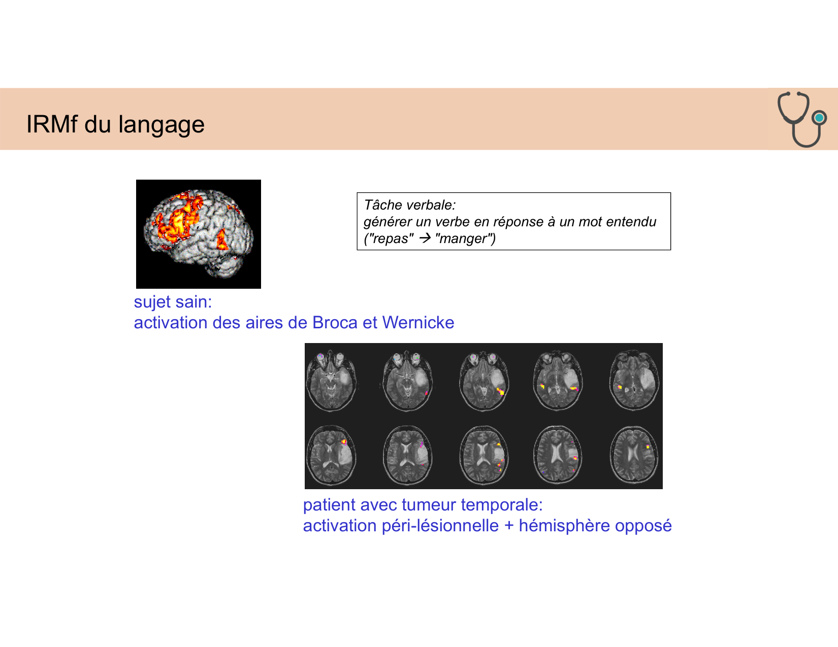 BA1 Techniques de Neuroimagerie page 43