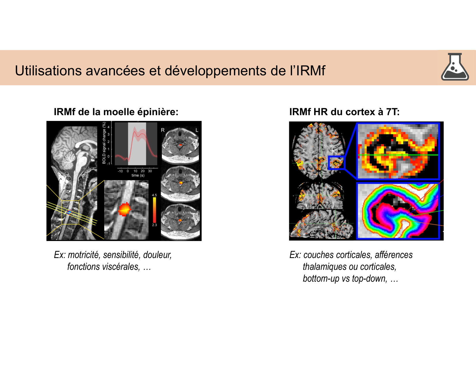 BA1 Techniques de Neuroimagerie page 44