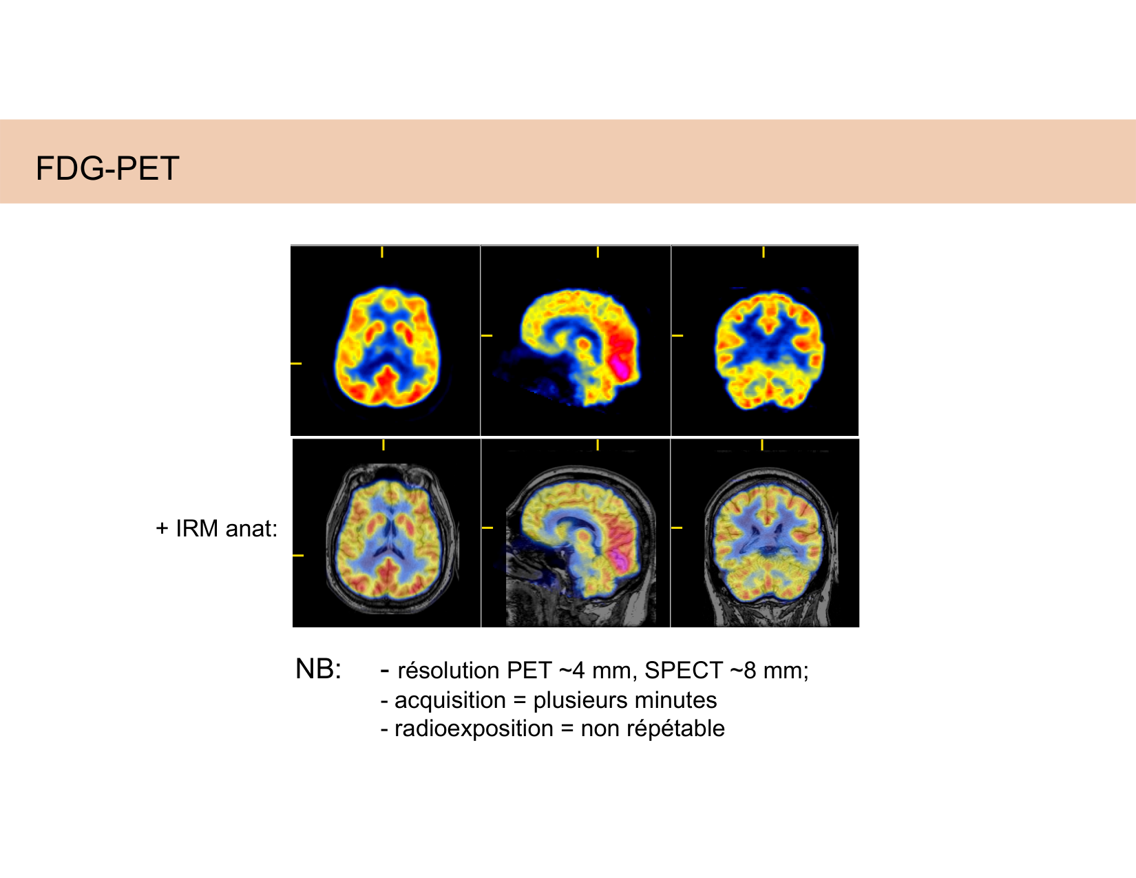 BA1 Techniques de Neuroimagerie page 49