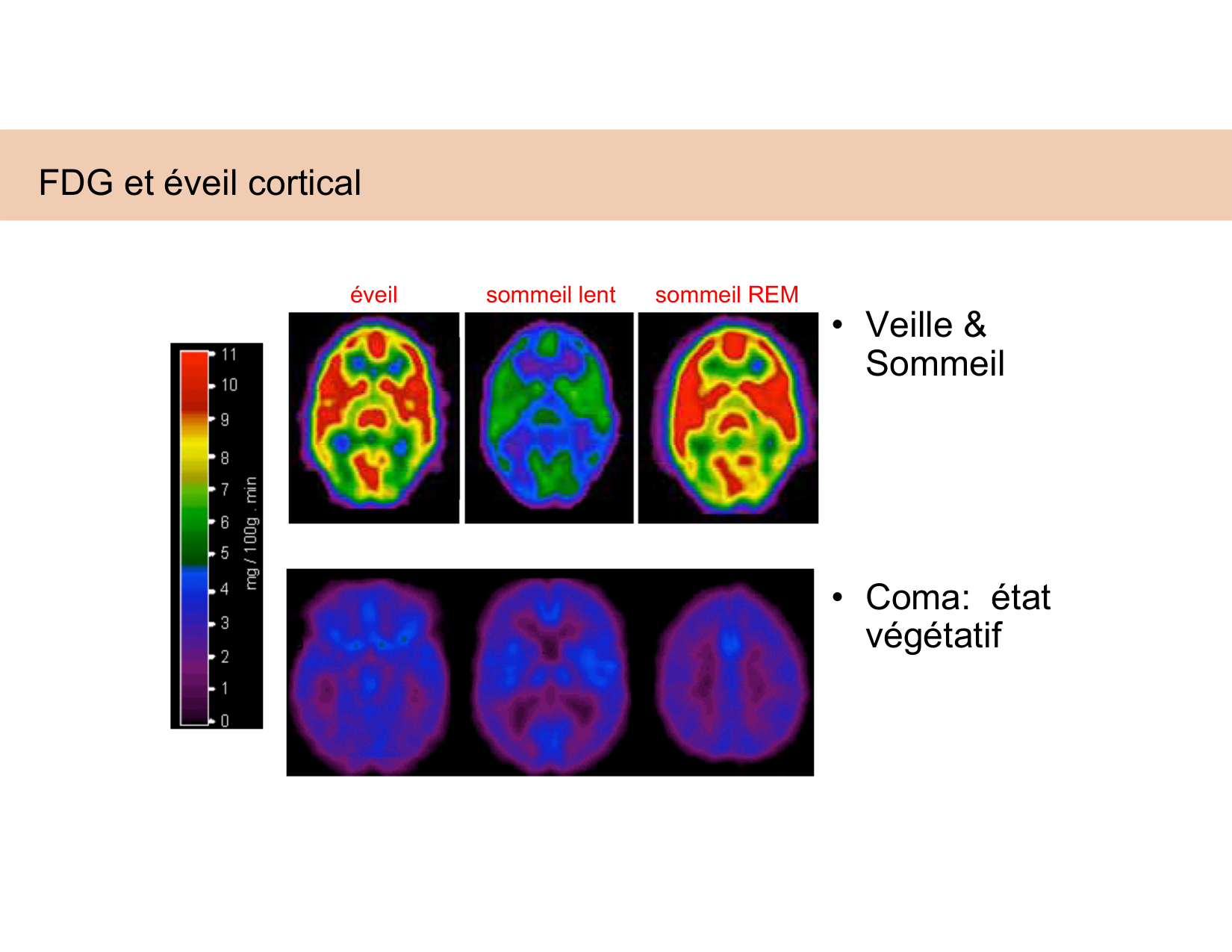 BA1 Techniques de Neuroimagerie page 50