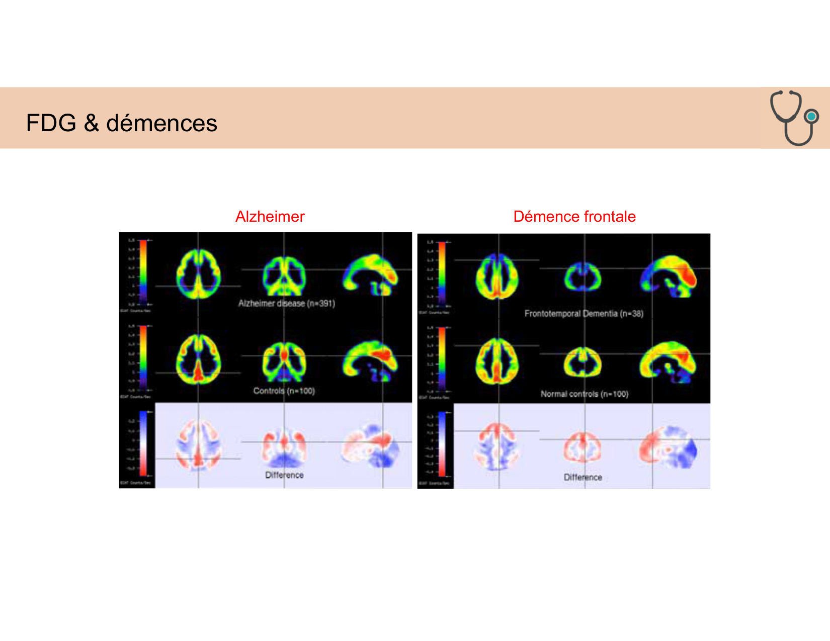 BA1 Techniques de Neuroimagerie page 51