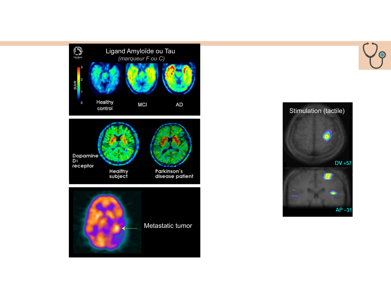 BA1 Techniques de Neuroimagerie page 52