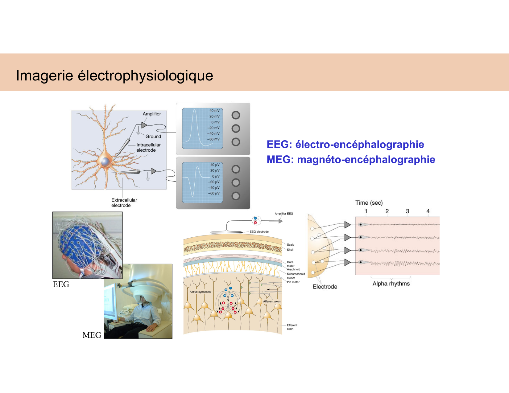 BA1 Techniques de Neuroimagerie page 53