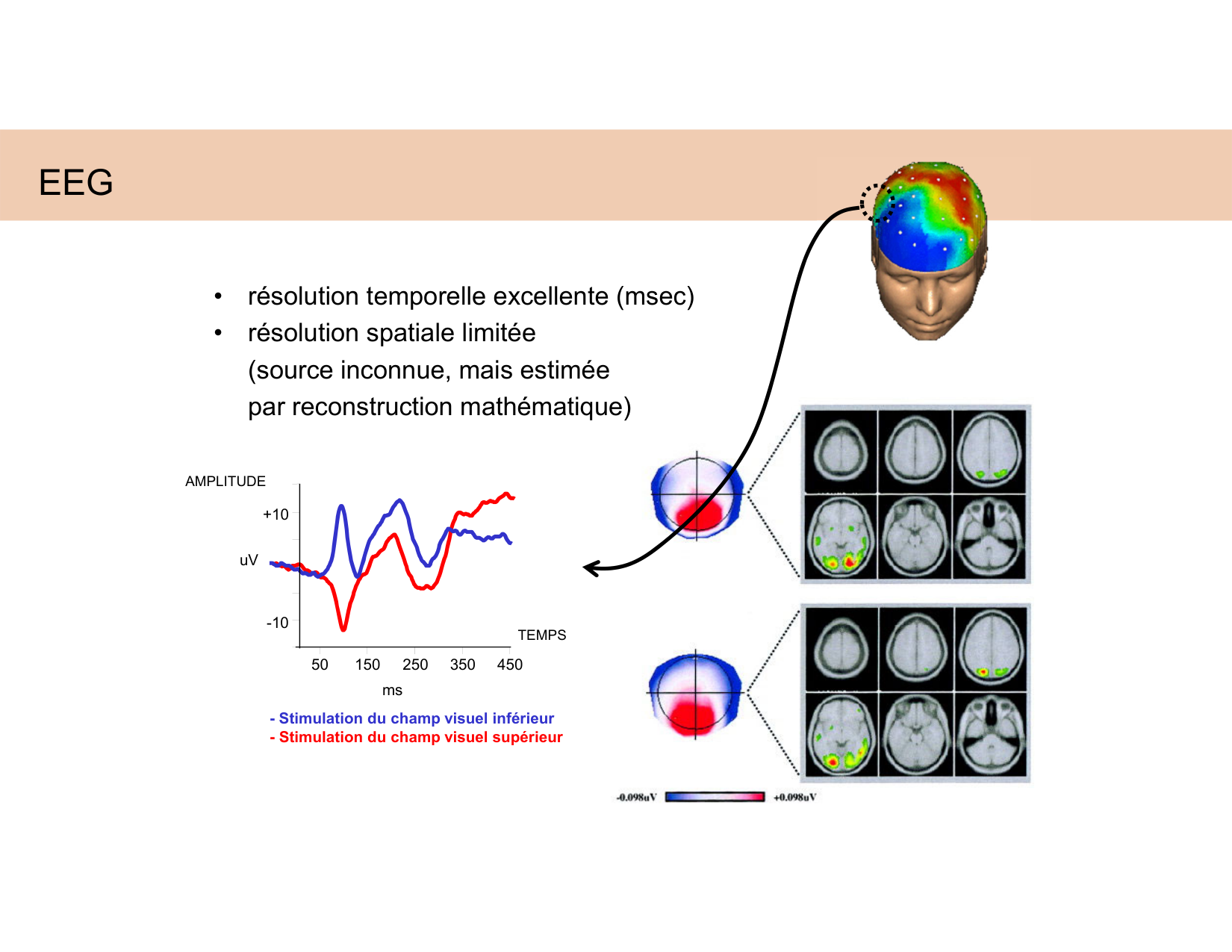 BA1 Techniques de Neuroimagerie page 54
