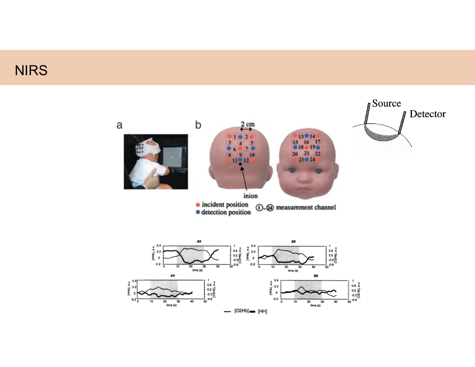 BA1 Techniques de Neuroimagerie page 55