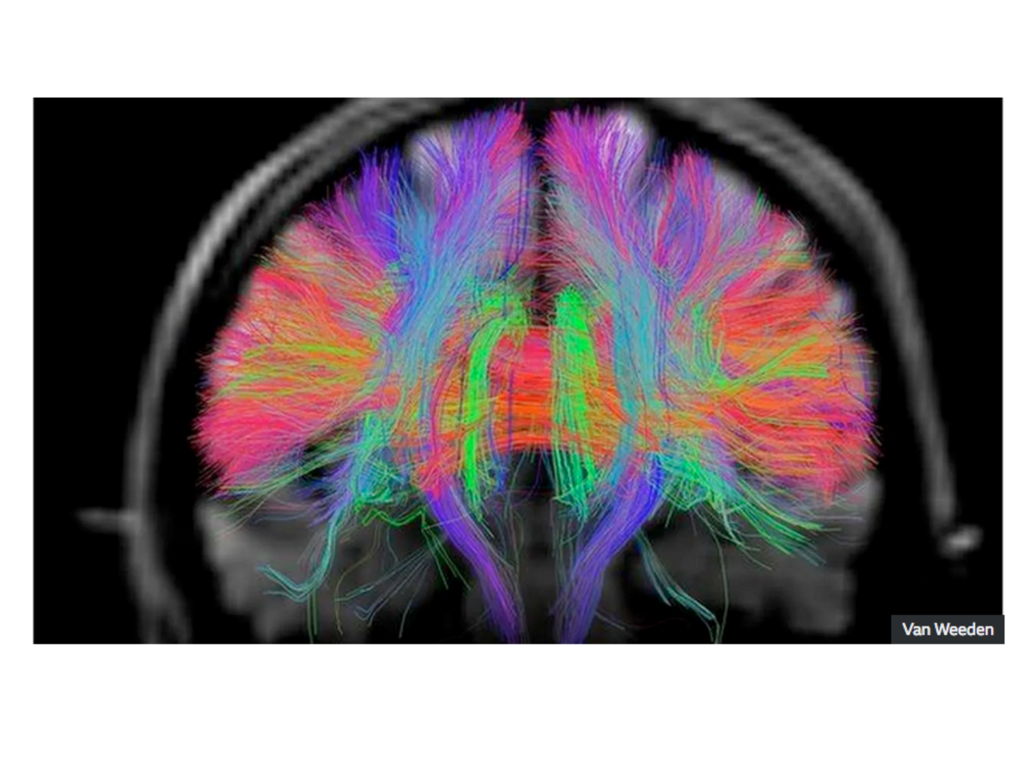 COURS 2025-2026 pdf 2024 2025 Développement du système nerveux- A. Ruiz i Altaba page 28