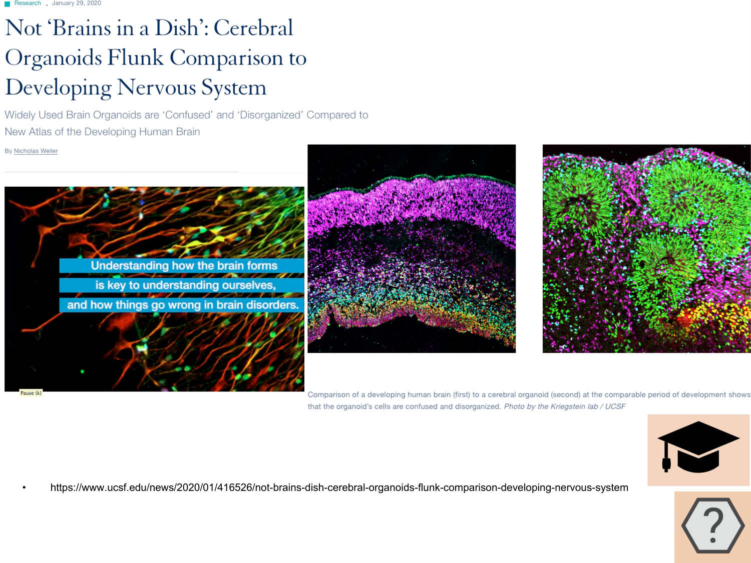 COURS 2025-2026 pdf 2024 2025 Développement du système nerveux- A. Ruiz i Altaba page 49