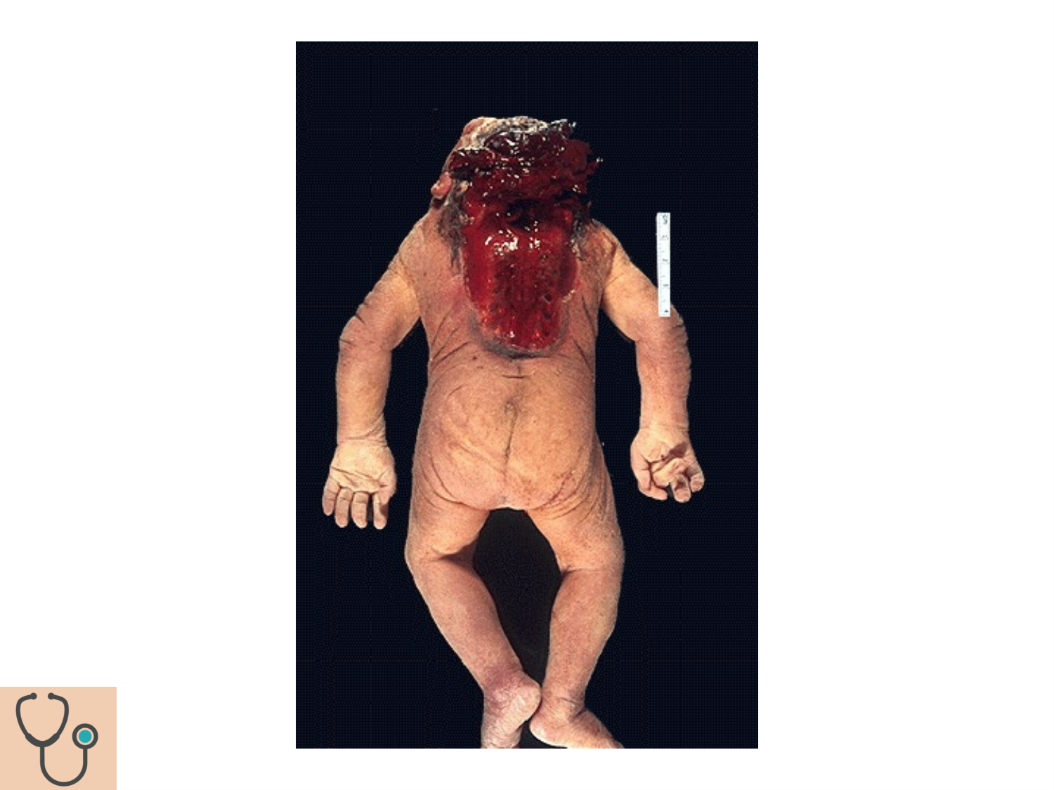 COURS 2025-2026 pdf 2024 2025 Développement du système nerveux- A. Ruiz i Altaba page 57