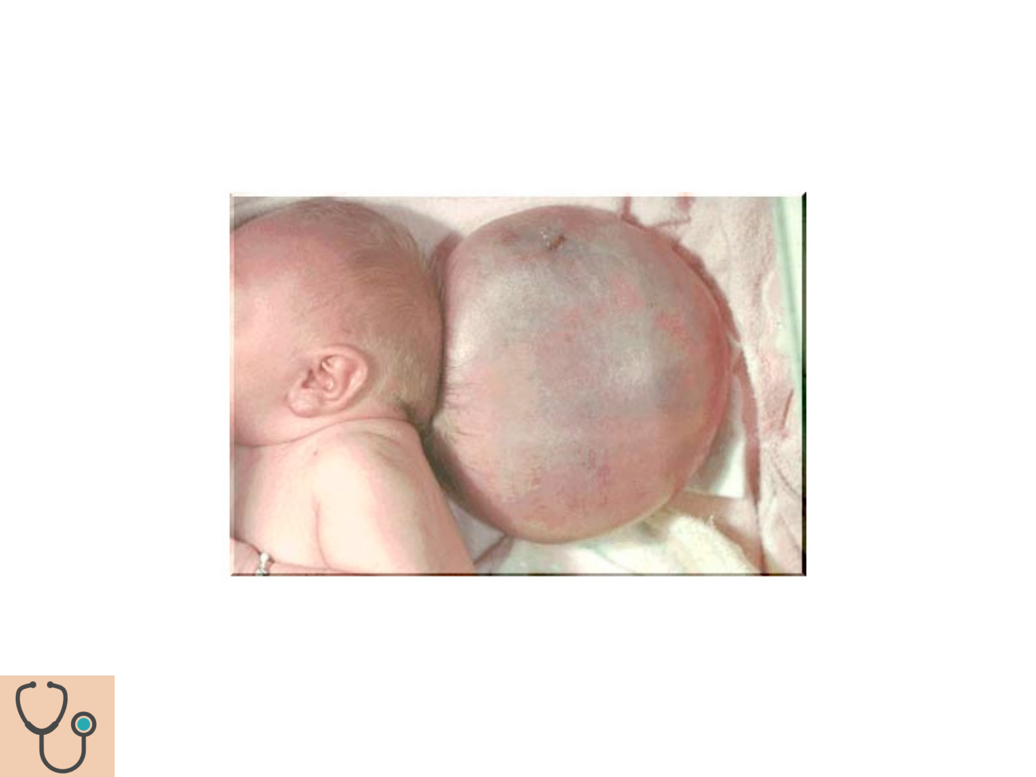 COURS 2025-2026 pdf 2024 2025 Développement du système nerveux- A. Ruiz i Altaba page 58