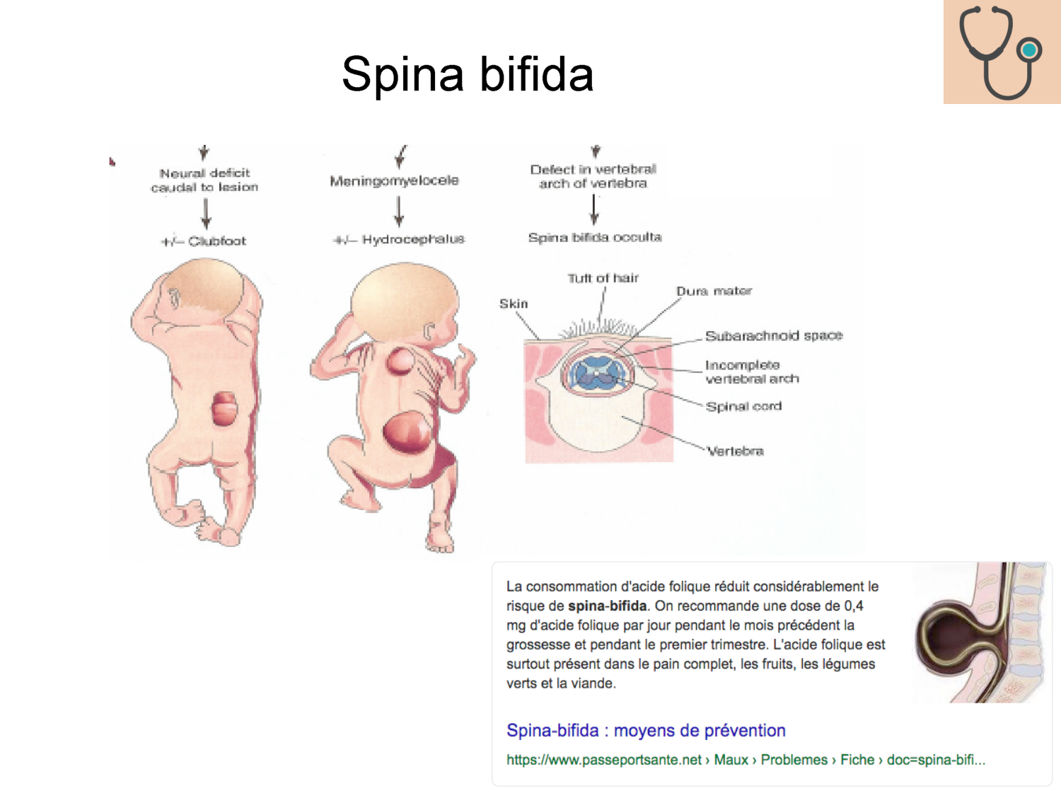COURS 2025-2026 pdf 2024 2025 Développement du système nerveux- A. Ruiz i Altaba page 60