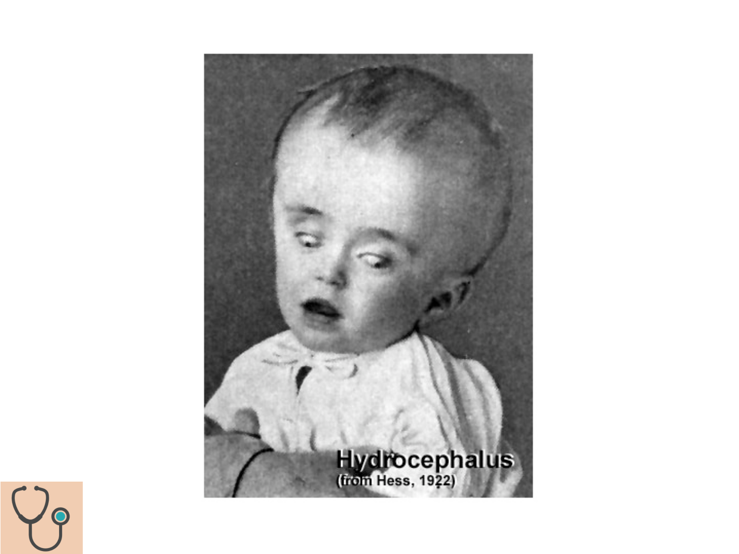 COURS 2025-2026 pdf 2024 2025 Développement du système nerveux- A. Ruiz i Altaba page 62