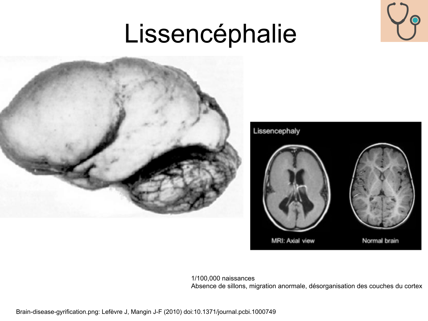 COURS 2025-2026 pdf 2024 2025 Développement du système nerveux- A. Ruiz i Altaba page 66