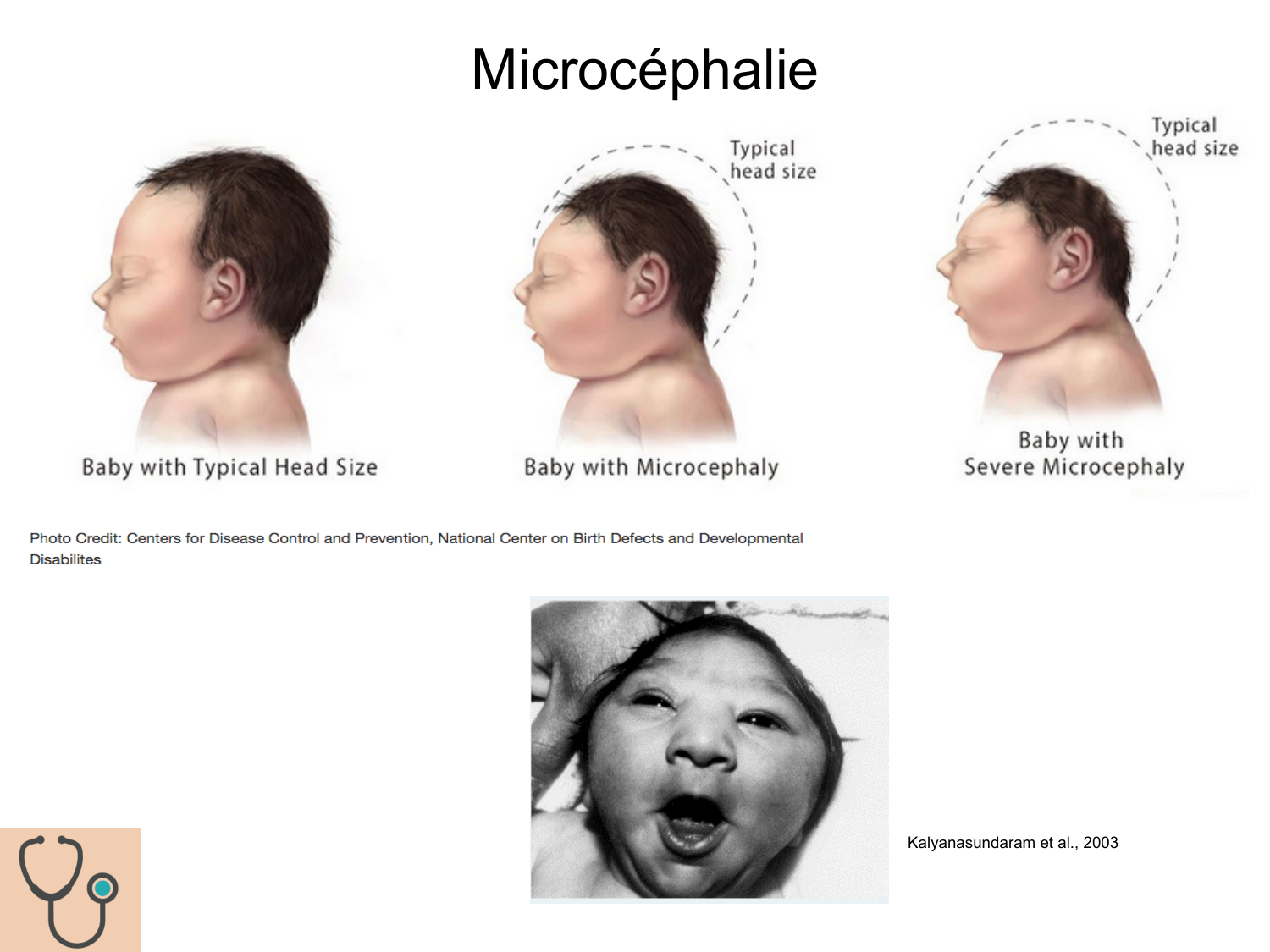 COURS 2025-2026 pdf 2024 2025 Développement du système nerveux- A. Ruiz i Altaba page 67